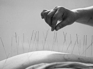 最全针灸资料库合集 32套