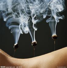 王本正刺血疗法视频教程 中医视频教程 刺络放血疗法 针挑疗法